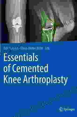 Essentials Of Cemented Knee Arthroplasty