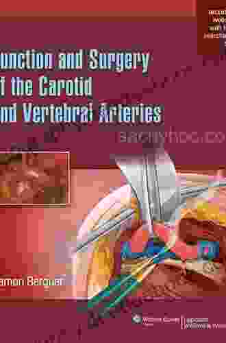 Function And Surgery Of The Carotid And Vertebral Arteries